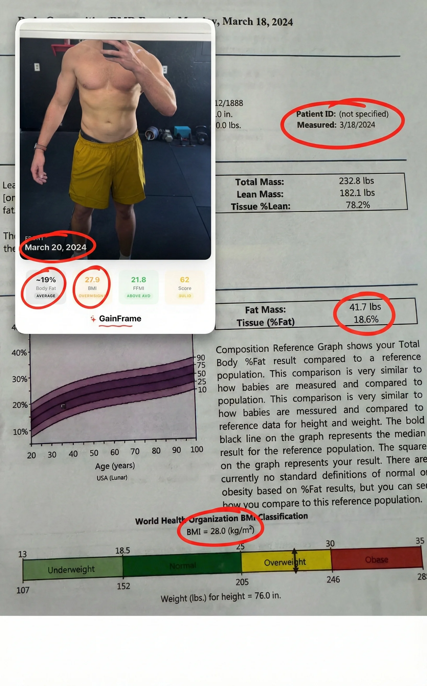 We compared an AI body fat scanner against a clinical DEXA scan. See how accurately GainFrame estimated body fat percentage, RMR, and muscle development.